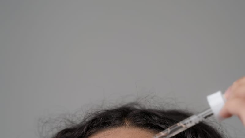 Close-up of a woman's face with a focus on areas prone to dark spots, illustrating the journey to clear skin.