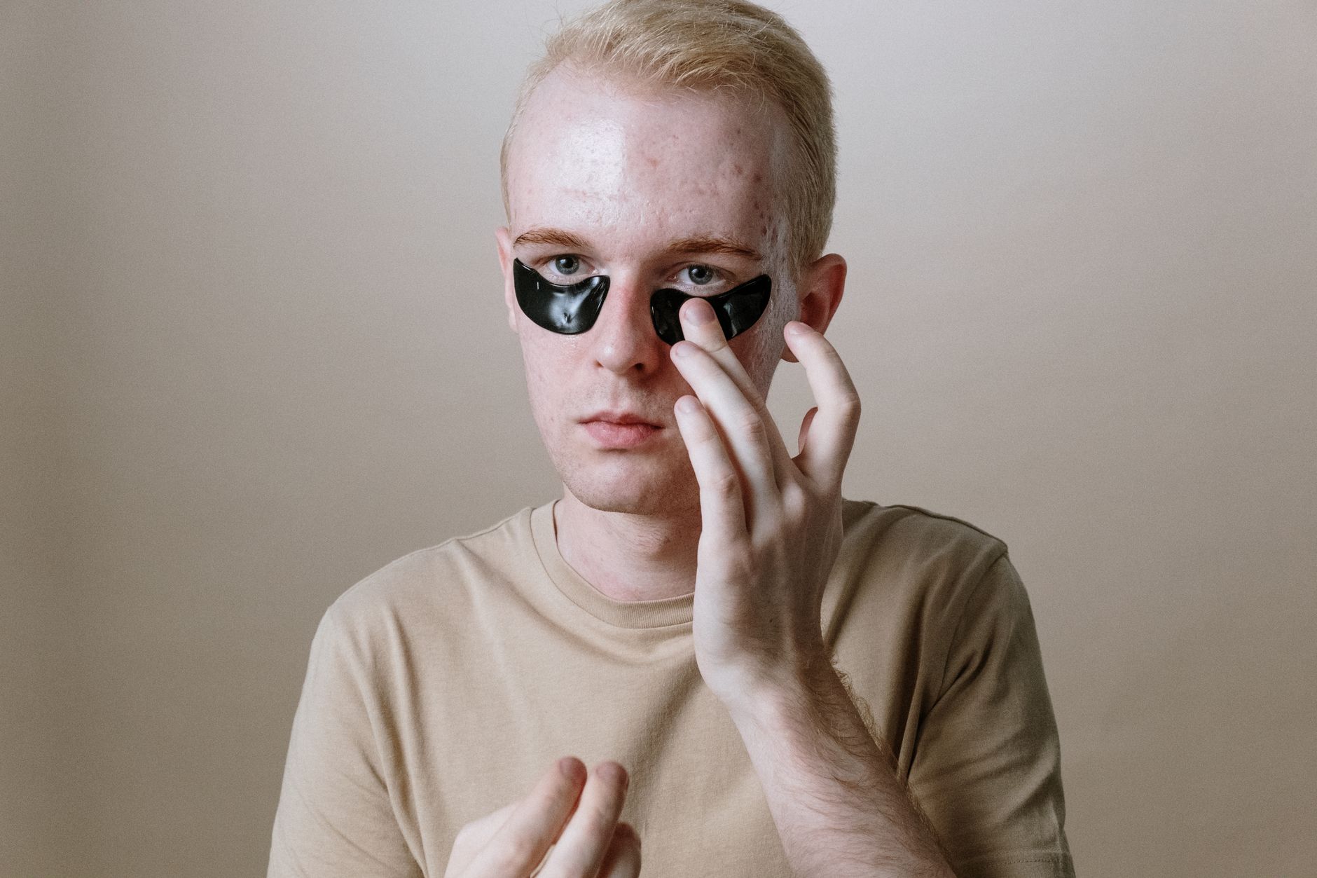 Woman gently touching her chin, illustrating the common area for hormonal acne, with a soft, glowing complexion.